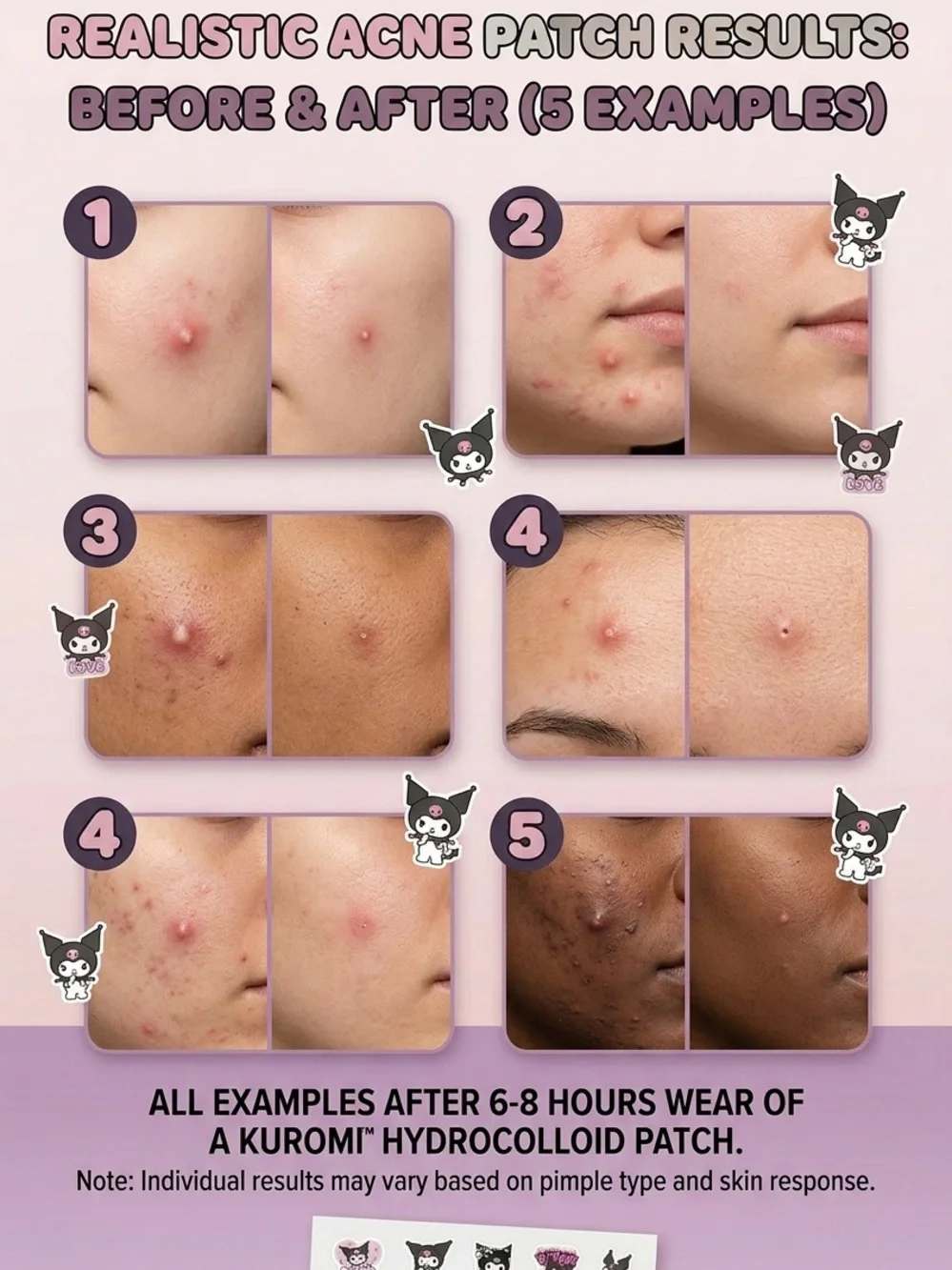 Acne Spot Cover Pimple Patch - Black Cute Cartoon Design